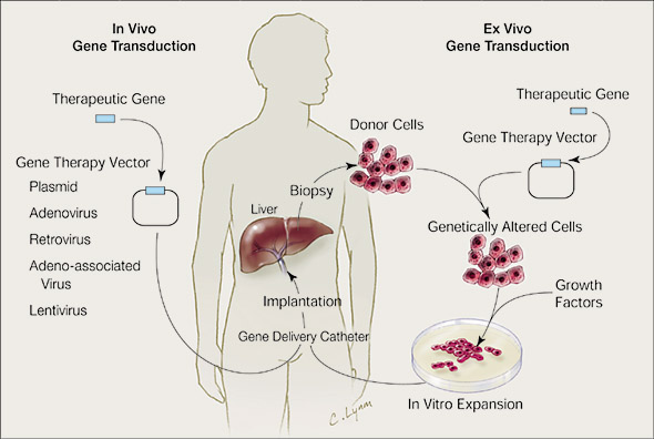 Types Of Gene Therapy